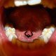 Illustration for article titled R.I.P. Tongue Frenulum Ring